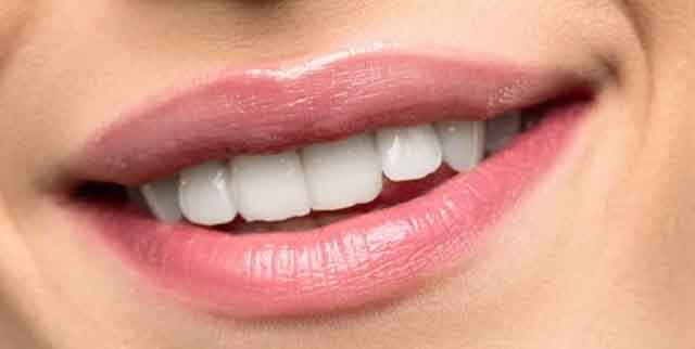 What Can I Drink After Teeth Whitening?
